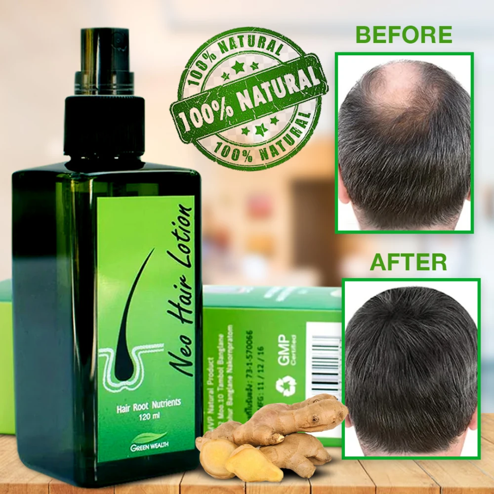 New Hair Lotion Treatment 120ml | بخاخ نيو هير لعلاج تساقط الشعر